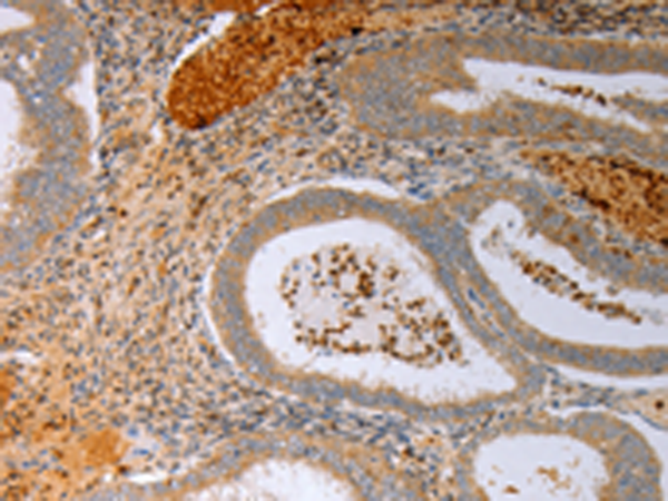 Rabbit Polyclonal Antibody to FOXN1