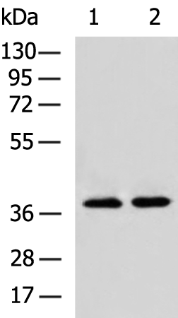 Rabbit Polyclonal Antibody to FOXN2