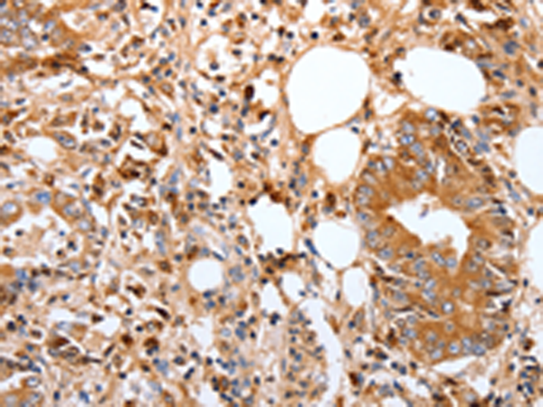 Rabbit Polyclonal Antibody to FOXO3