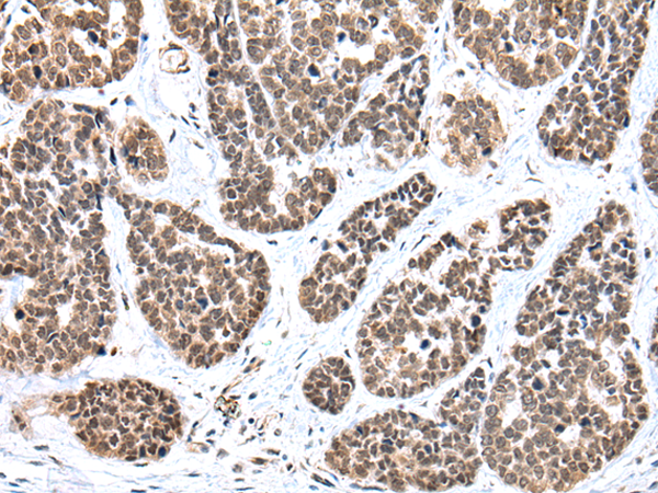 Rabbit Polyclonal Antibody to FOXP1
