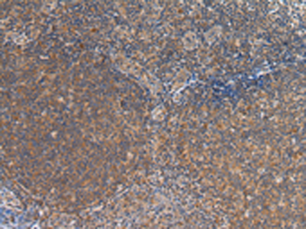 Rabbit Polyclonal Antibody to FST