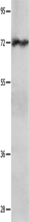 Rabbit Polyclonal Antibody to IGF2BP1