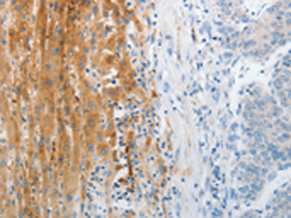 Rabbit Polyclonal Antibody to TRPM1