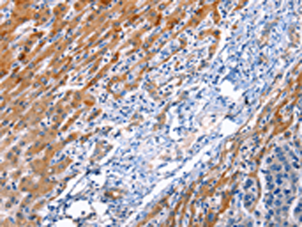 Rabbit Polyclonal Antibody to ID4