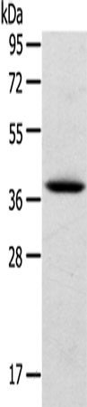 Rabbit Polyclonal Antibody to TPM2