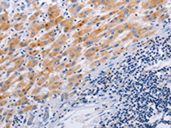 Rabbit Polyclonal Antibody to SLC9A3