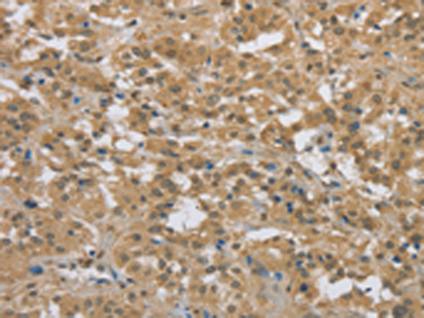 Rabbit Polyclonal Antibody to PKD1