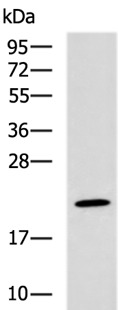 Rabbit Polyclonal Antibody to SUMO2/SUMO3/SUMO4