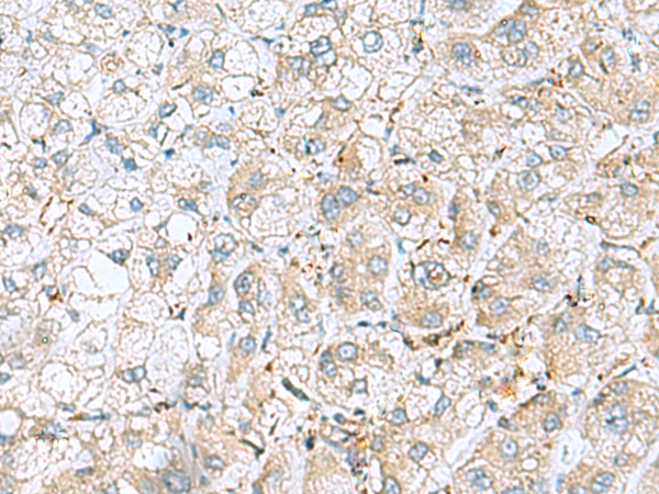 Rabbit Polyclonal Antibody to GABRR1