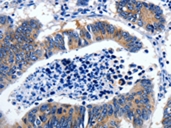 Rabbit Polyclonal Antibody to GAD2