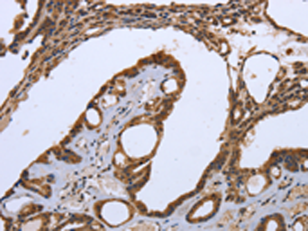 Rabbit Polyclonal Antibody to CXCR3