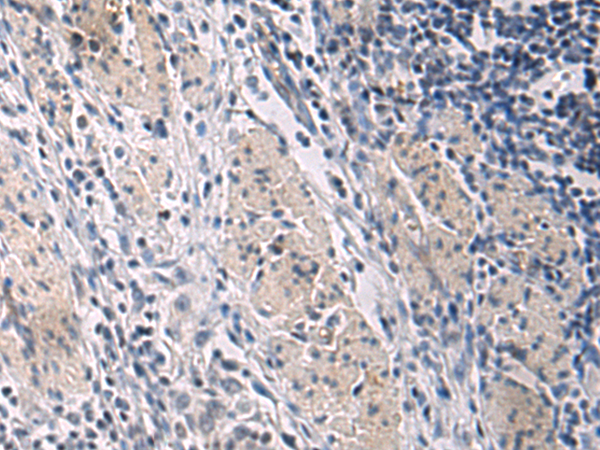 Rabbit Polyclonal Antibody to CCKBR