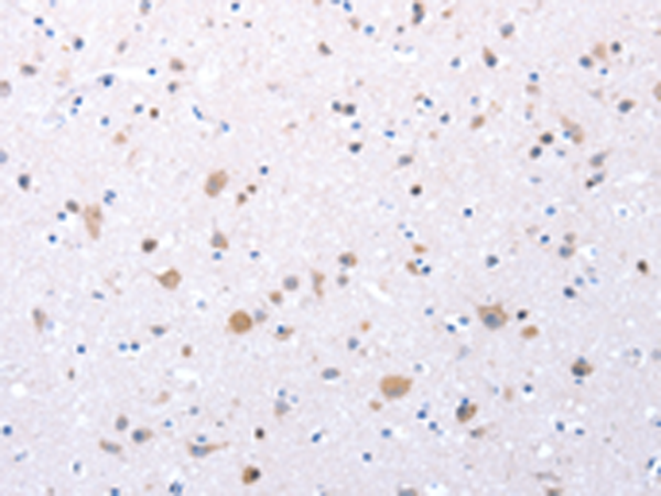 Rabbit Polyclonal Antibody to CCKAR