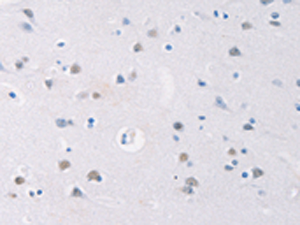 Rabbit Polyclonal Antibody to GATA4