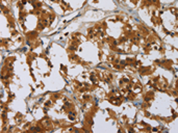 Rabbit Polyclonal Antibody to GATA5