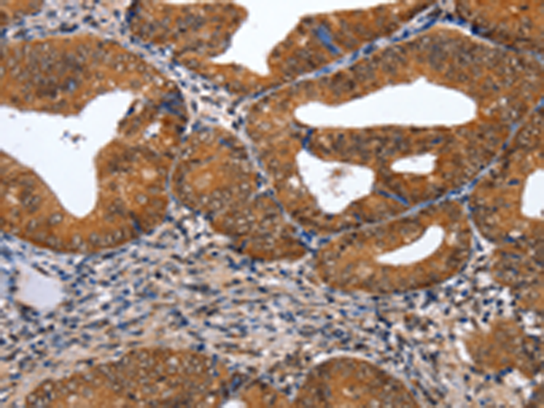 Rabbit Polyclonal Antibody to GATA6