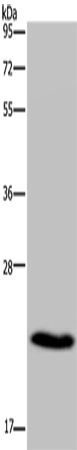 Rabbit Polyclonal Antibody to CMTM5