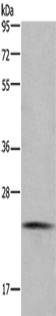 Rabbit Polyclonal Antibody to CMTM6