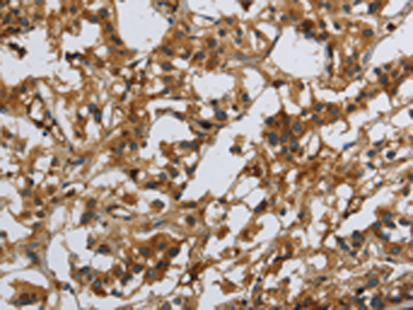 Rabbit Polyclonal Antibody to CMTM8