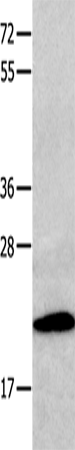 Rabbit Polyclonal Antibody to CMTM3