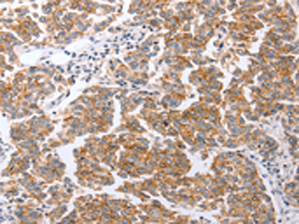 Rabbit Polyclonal Antibody to CLDN3