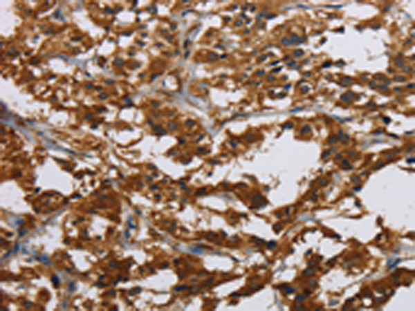 Rabbit Polyclonal Antibody to CLDN2