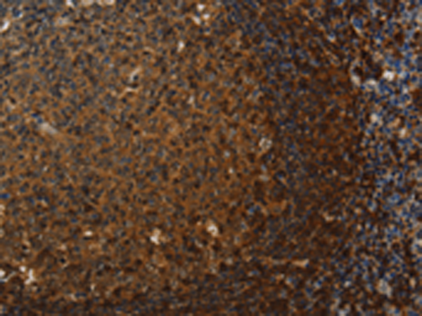 Rabbit Polyclonal Antibody to CLDN8