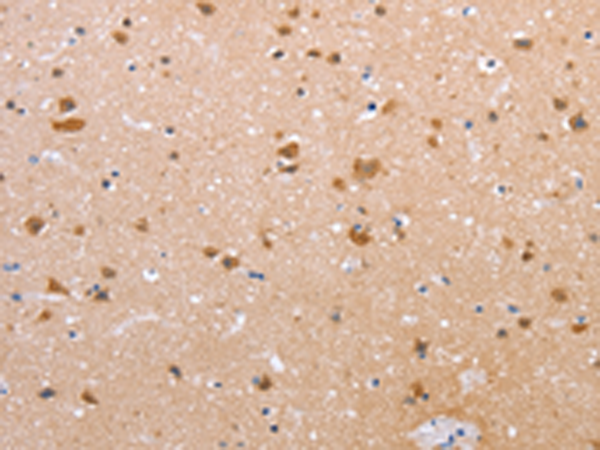 Rabbit Polyclonal Antibody to CLDN10