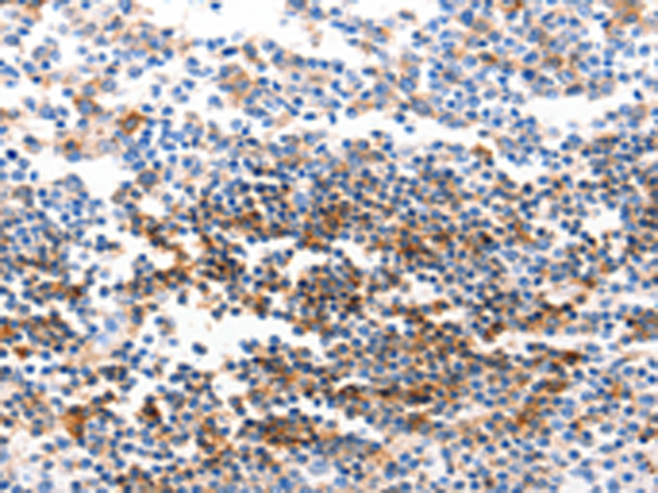 Rabbit Polyclonal Antibody to GJB6