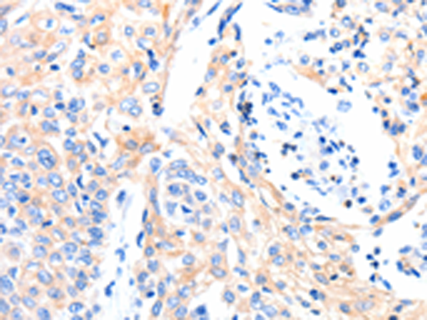 Rabbit Polyclonal Antibody to GAS6