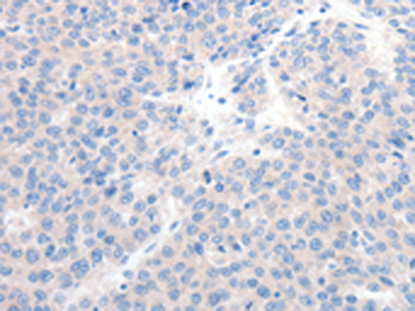 Rabbit Polyclonal Antibody to GCK