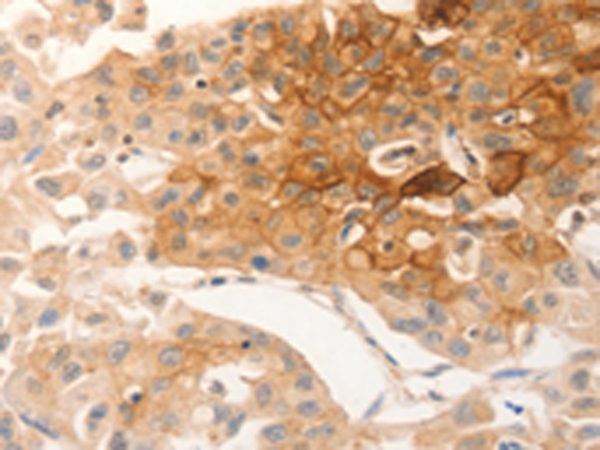 Rabbit Polyclonal Antibody to CSF3R