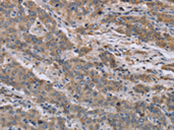 Rabbit Polyclonal Antibody to GSN