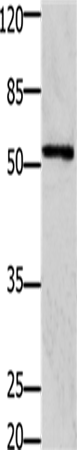Rabbit Polyclonal Antibody to GFRA1