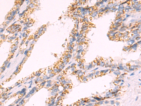 Rabbit Polyclonal Antibody to GFRA3