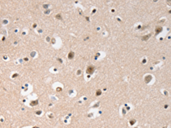 Rabbit Polyclonal Antibody to GCG(GLP1)