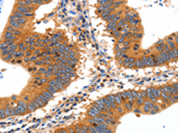 Rabbit Polyclonal Antibody to SLC2A2