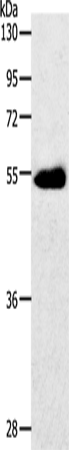 Rabbit Polyclonal Antibody to SLC2A3