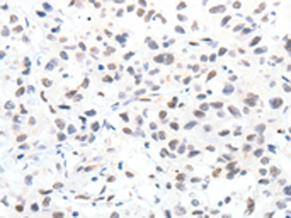 Rabbit Polyclonal Antibody to SLC2A4