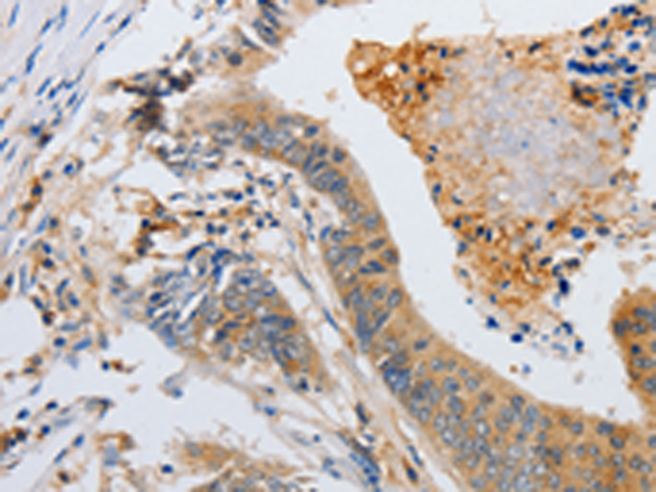 Rabbit Polyclonal Antibody to SLC2A5