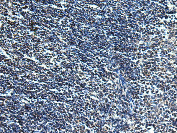 Rabbit Polyclonal Antibody to SLC2A12