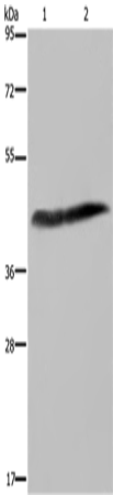 Rabbit Polyclonal Antibody to CSF2RA