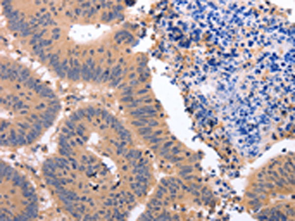 Rabbit Polyclonal Antibody to NR3C1