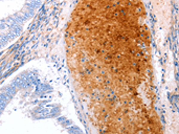 Rabbit Polyclonal Antibody to GRB10