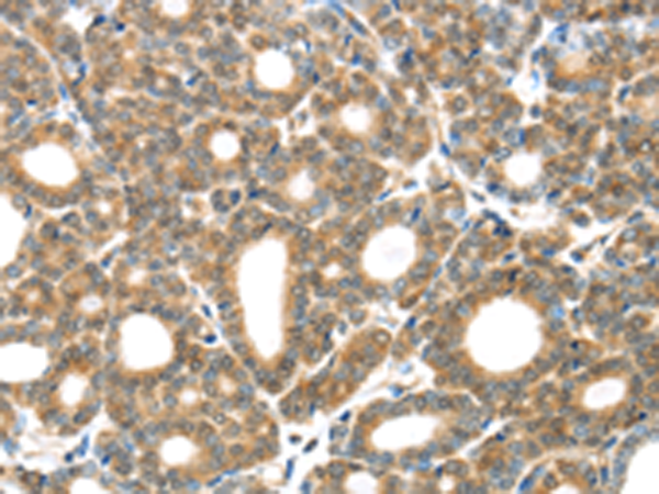 Rabbit Polyclonal Antibody to GZMK