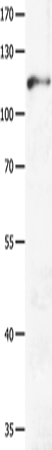 Rabbit Polyclonal Antibody to GRM3