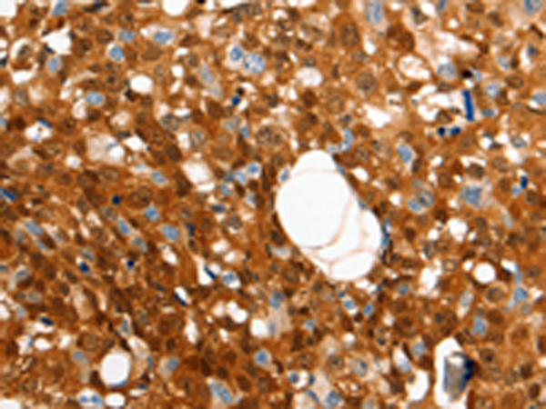 Rabbit Polyclonal Antibody to GRM4