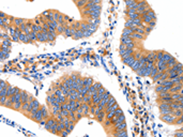 Rabbit Polyclonal Antibody to GRM1