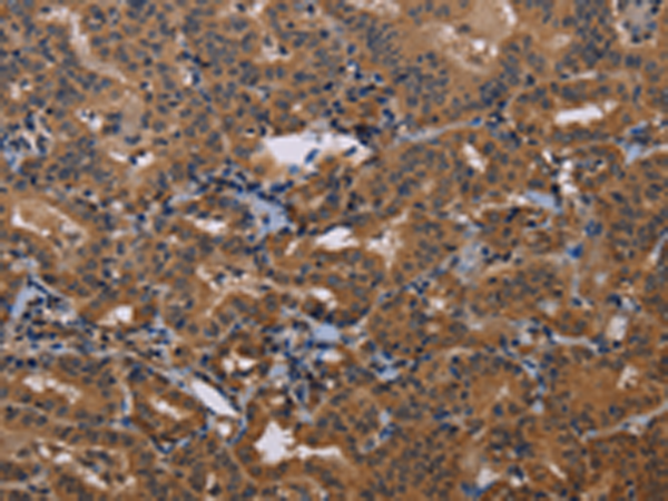 Rabbit Polyclonal Antibody to GRK1