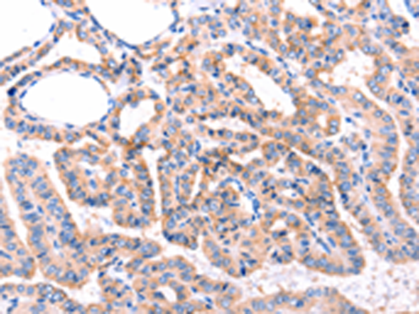 Rabbit Polyclonal Antibody to GRK2